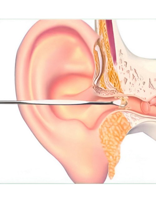 Set Kit Limpieza Higiene Cera Oídos Orejas Reutilizable