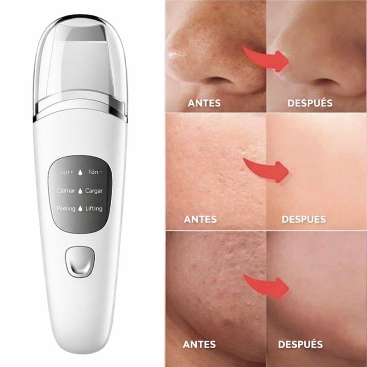 Limpiador Facial Ultrasónico Removedor De Puntos Negros Pro