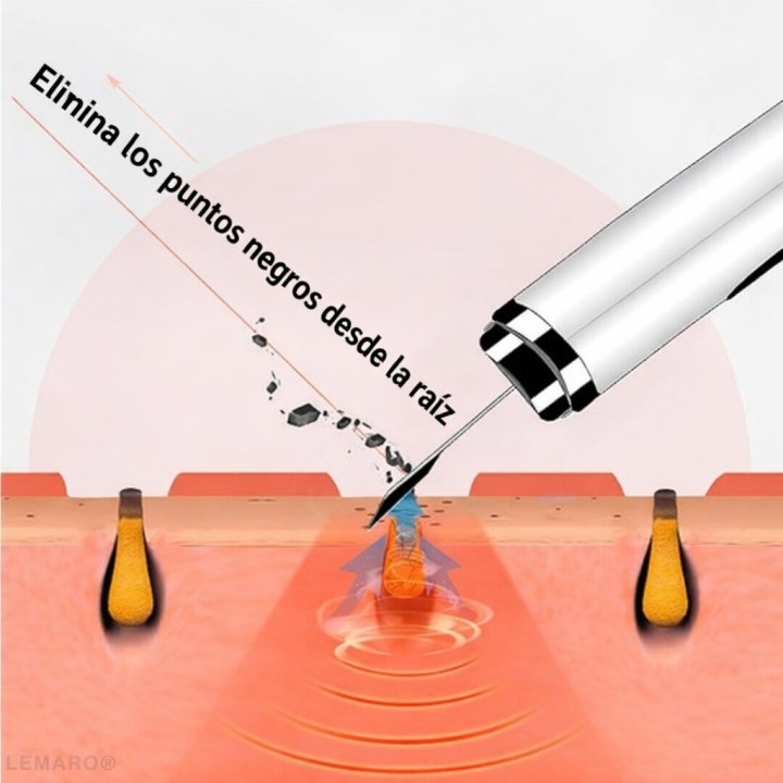 Limpiador Facial Ultrasónico Removedor De Puntos Negros Pro