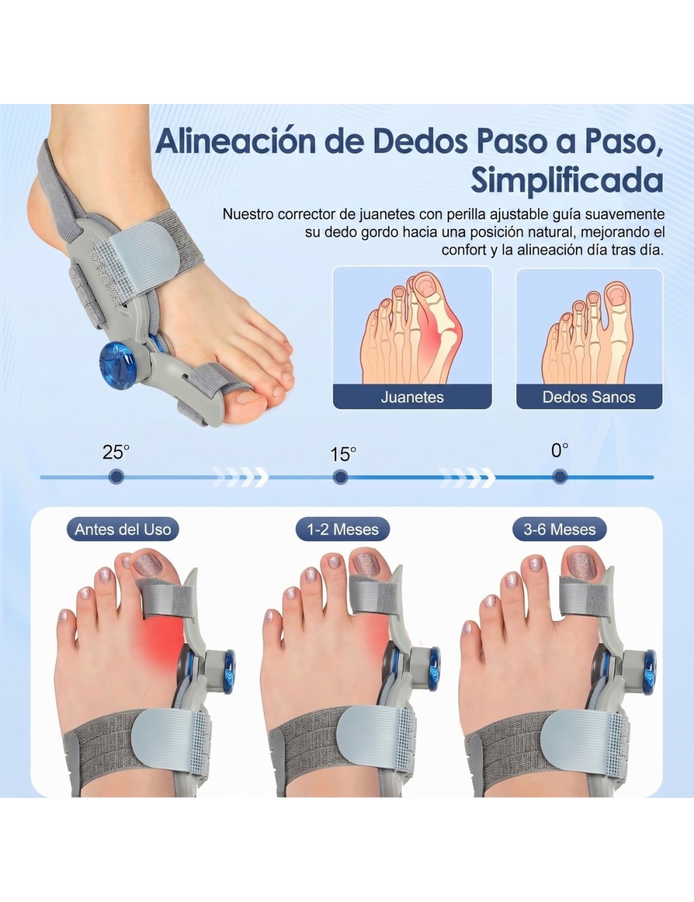 Corrector De Juanetes Ortopédico Ajustable Perilla Izq/der